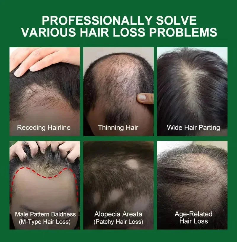 Hair Growth Serum Spray - Anti Hair Loss Scalp Treatment