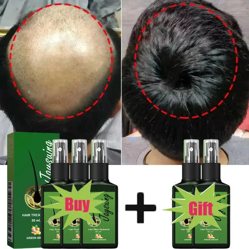 Hair Growth Serum Spray - Anti Hair Loss Scalp Treatment