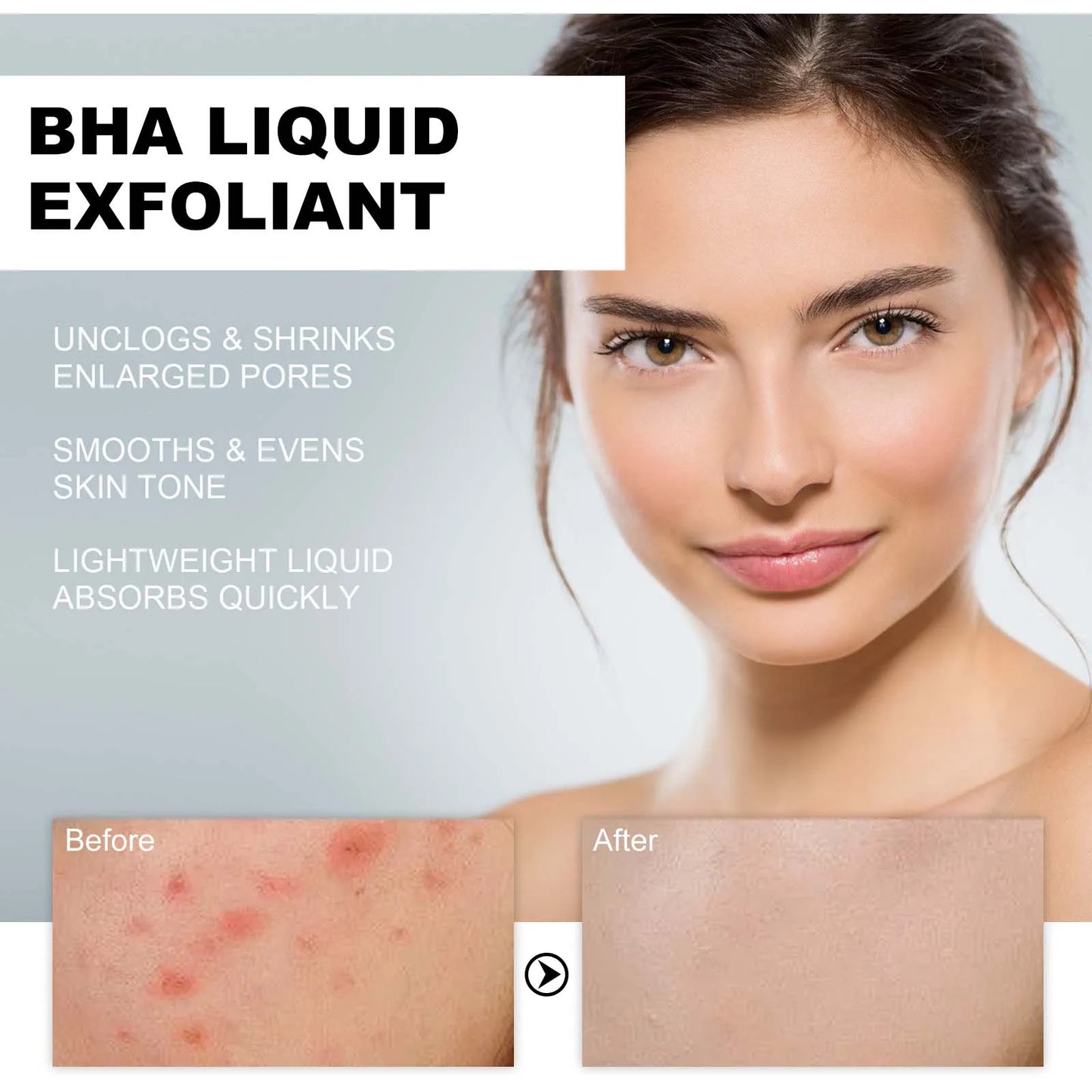 Salicylic Acid Serum 2% - Pore Minimizer & Exfoliant