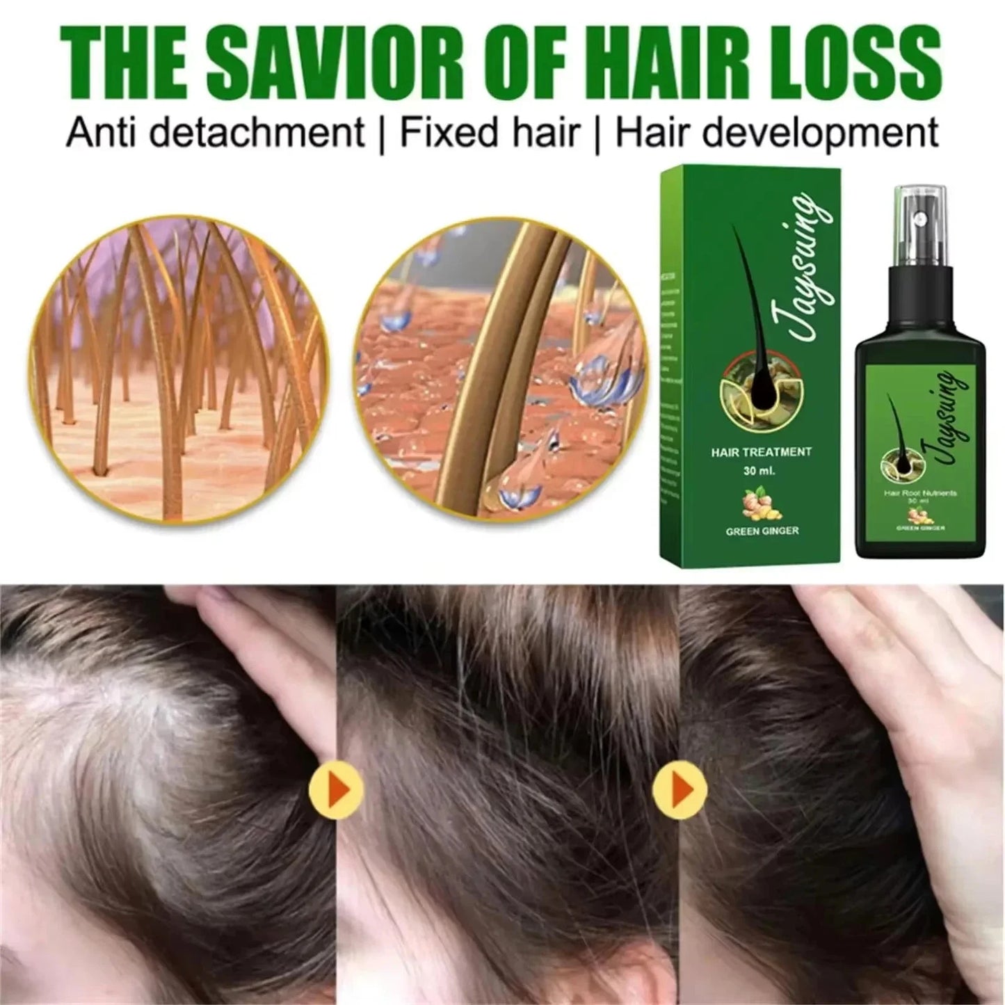 Hair Growth Serum Spray - Anti Hair Loss Scalp Treatment