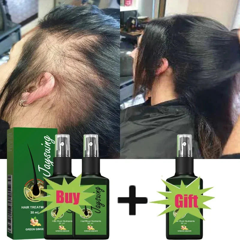 Hair Growth Serum Spray - Anti Hair Loss Scalp Treatment