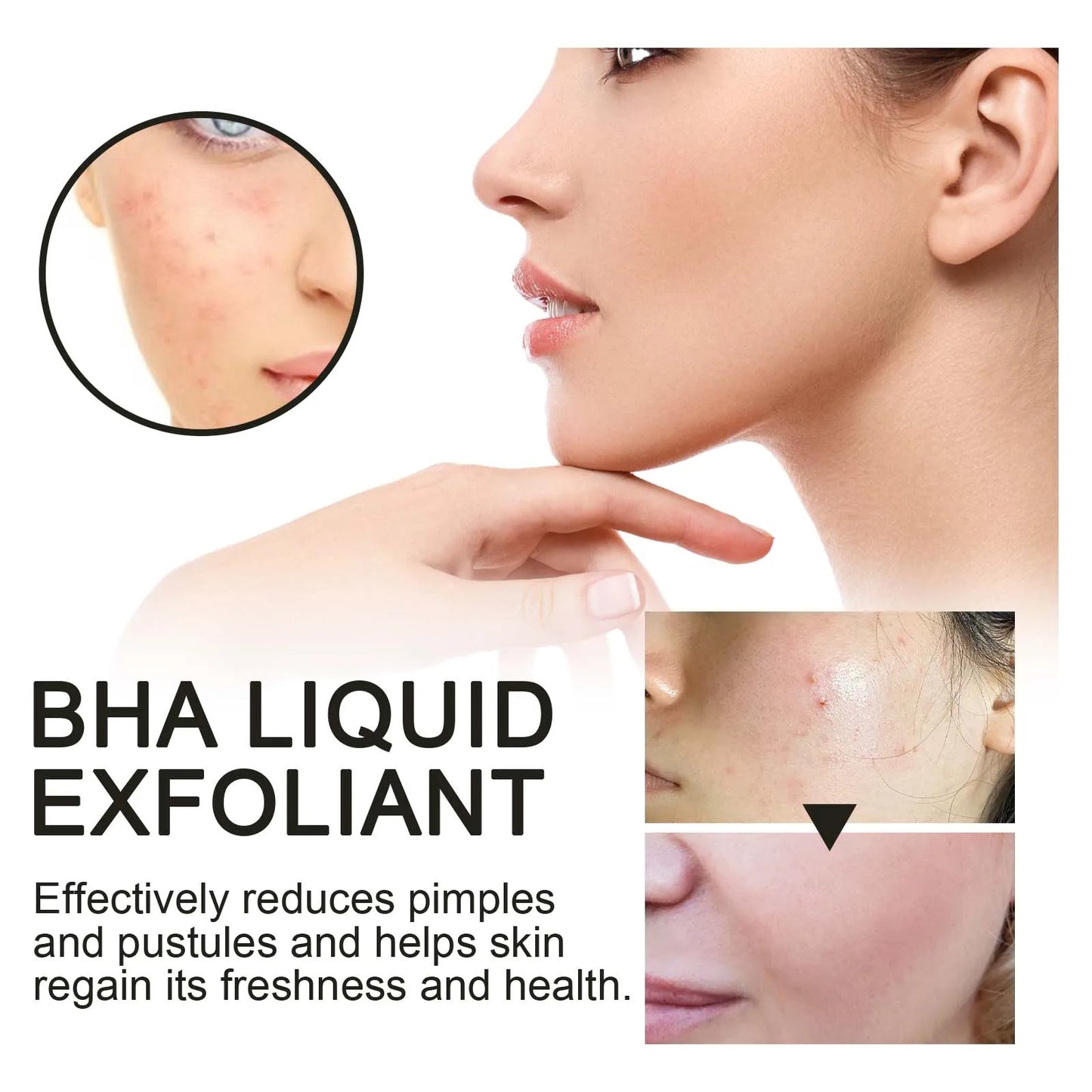 Salicylic Acid Serum 2% - Pore Minimizer & Exfoliant