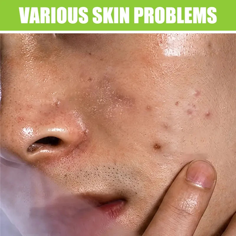 Face Wash for Men - Salicylic Acid Deep Cleanser