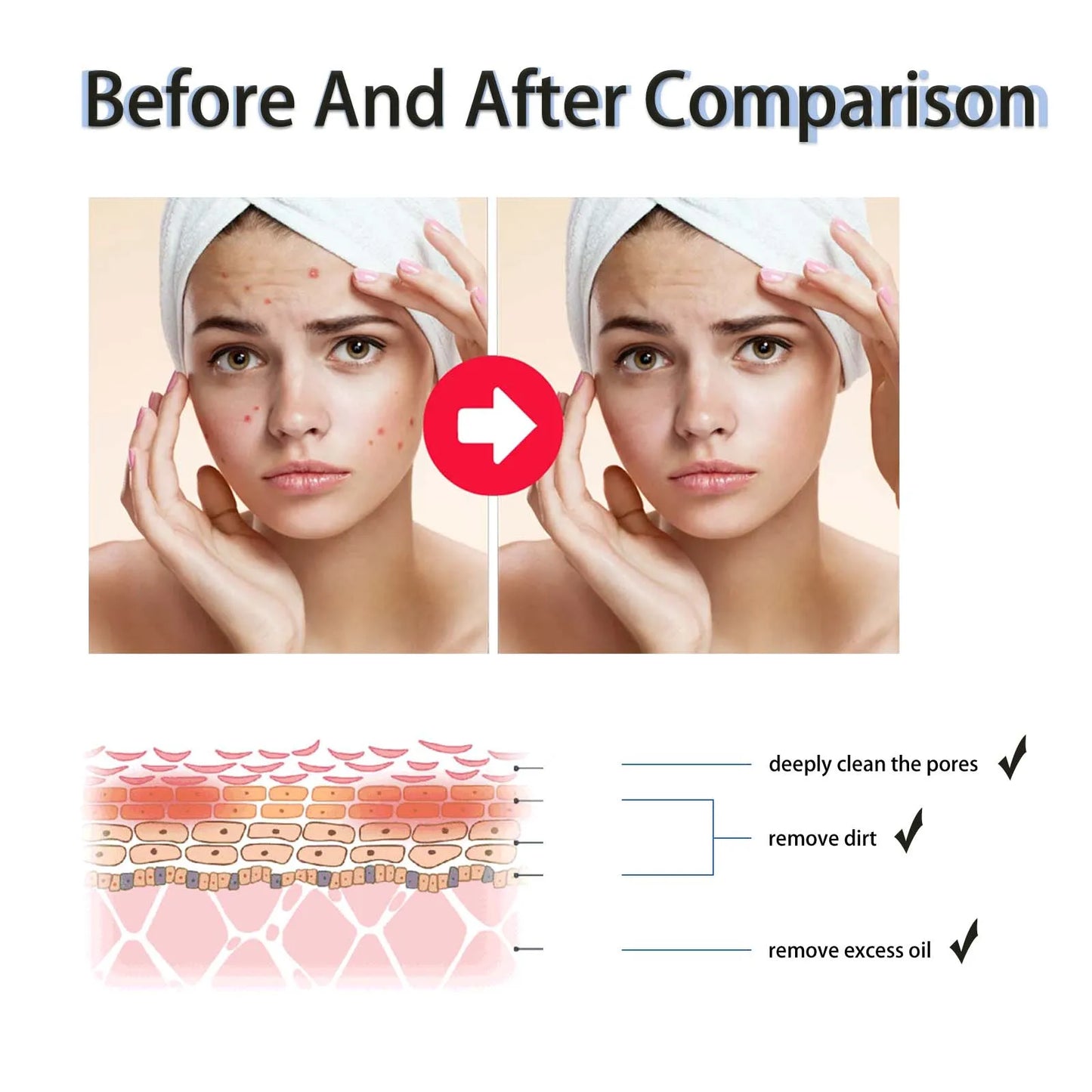 Salicylic Acid Serum 2% - Pore Minimizer & Exfoliant