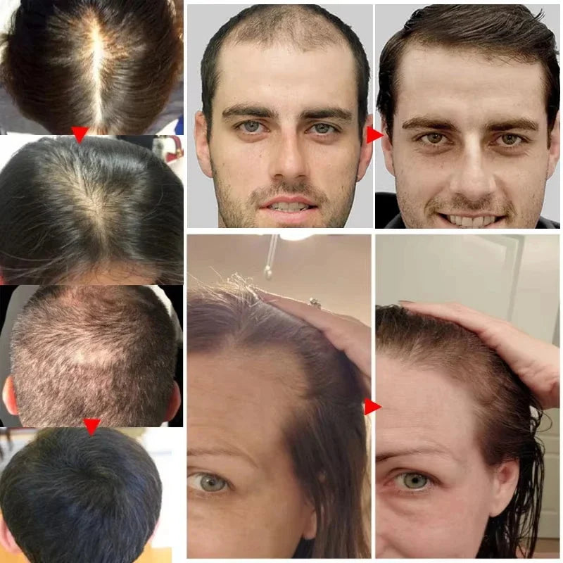 Hair Growth Serum Spray - Anti Hair Loss Scalp Treatment