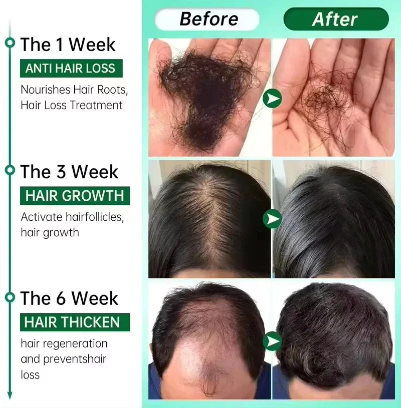 Hair Growth Serum Spray - Anti Hair Loss Scalp Treatment